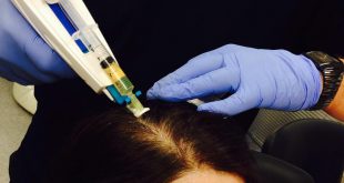 Was ist Mesotherapie und stimuliert es das Haarwachstum?  