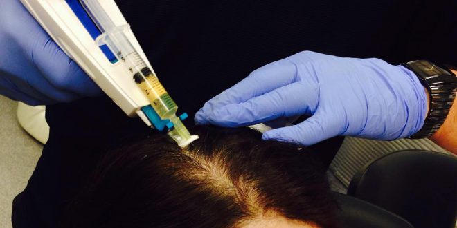 Was ist Mesotherapie und stimuliert es das Haarwachstum? 
