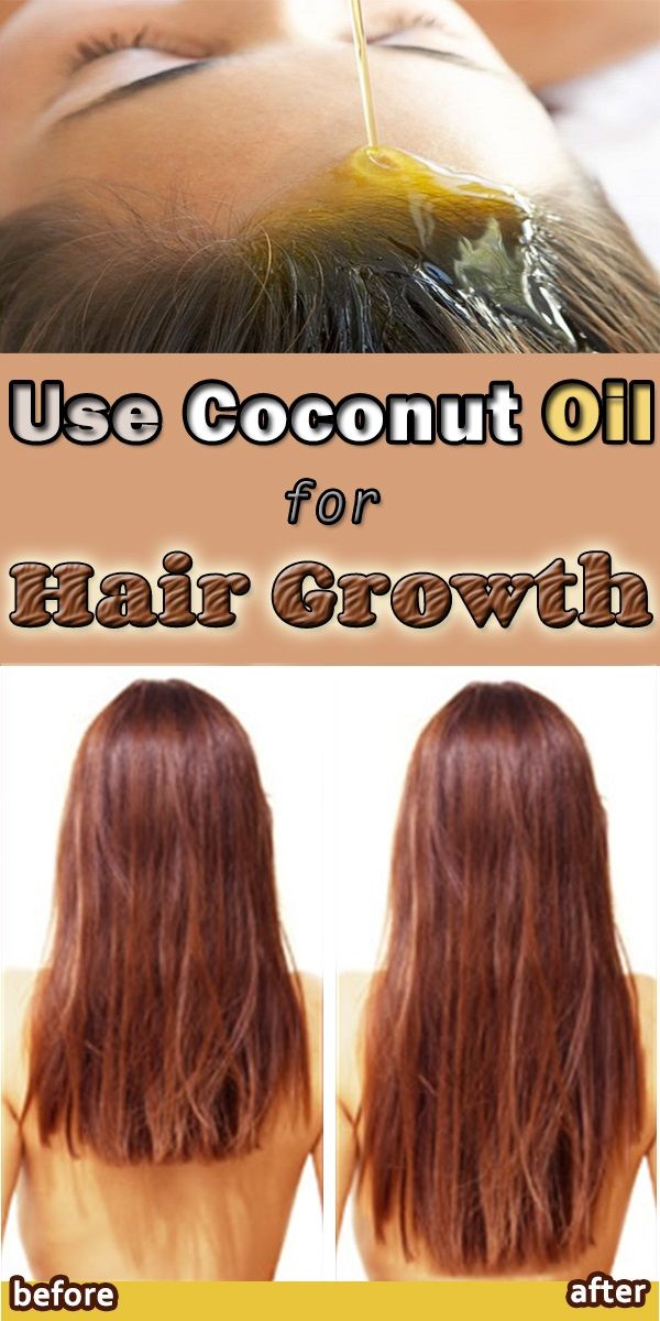 20 beste Öle für das Haarwachstum - Tipps und Heilmittel für das Haarwachstum 